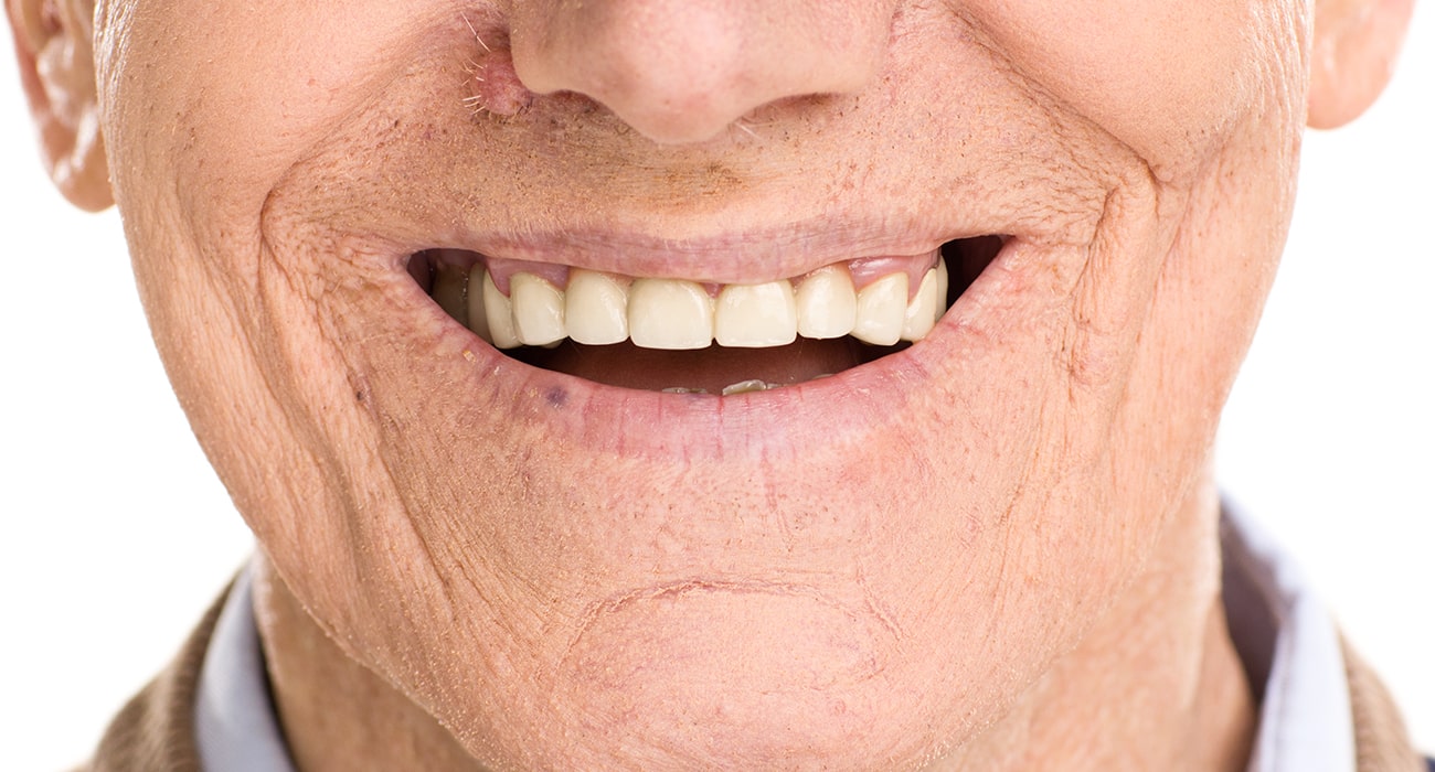 How Dentures Affect Your Facial Structure and Appearance