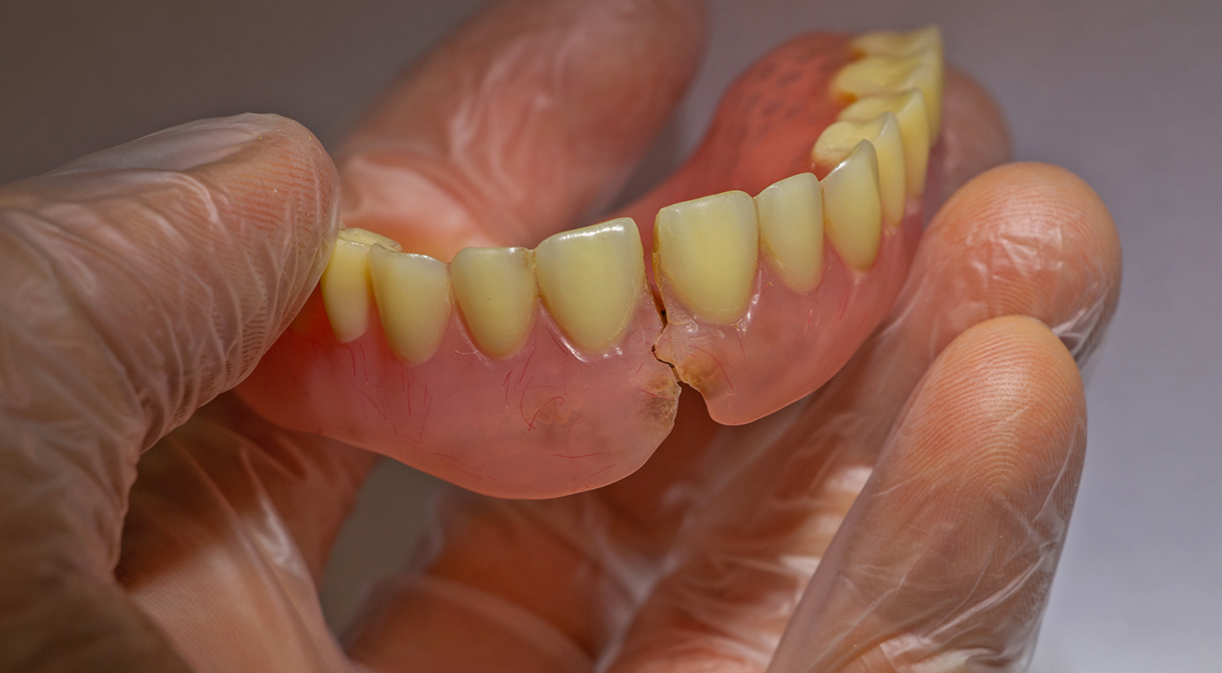 Dentures In Athens, GA
